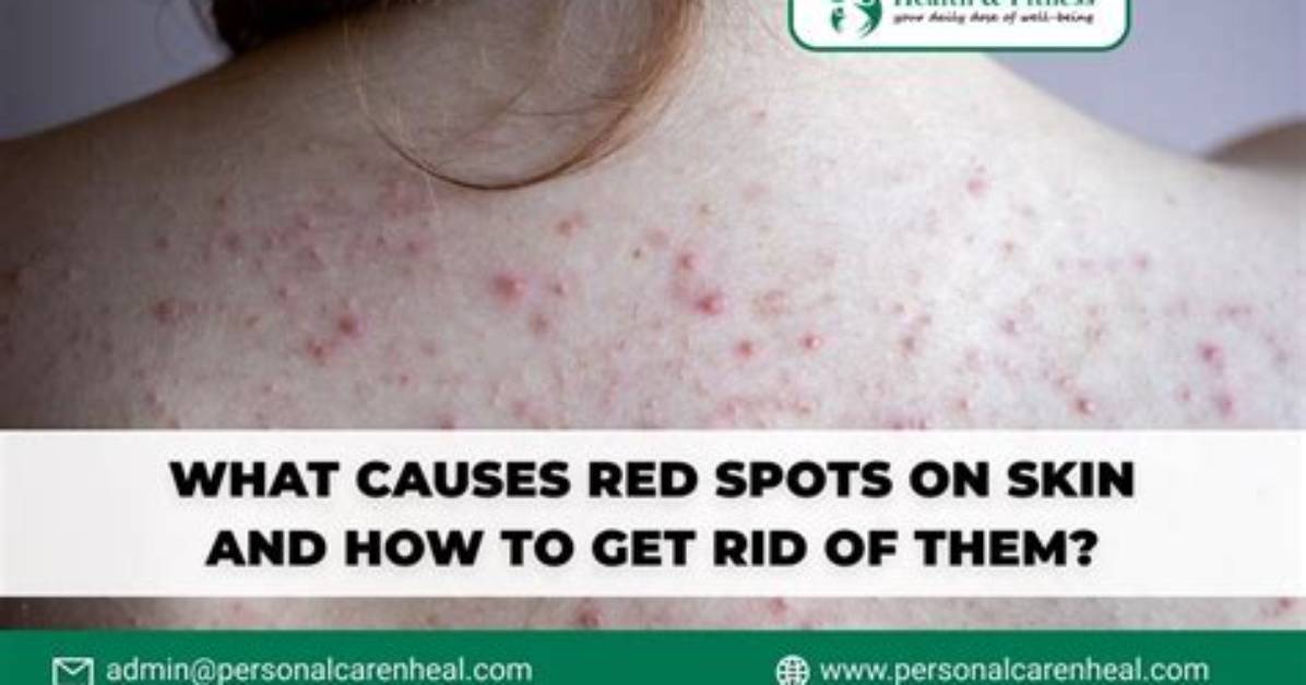 How Sick Can You Get from Red Tide