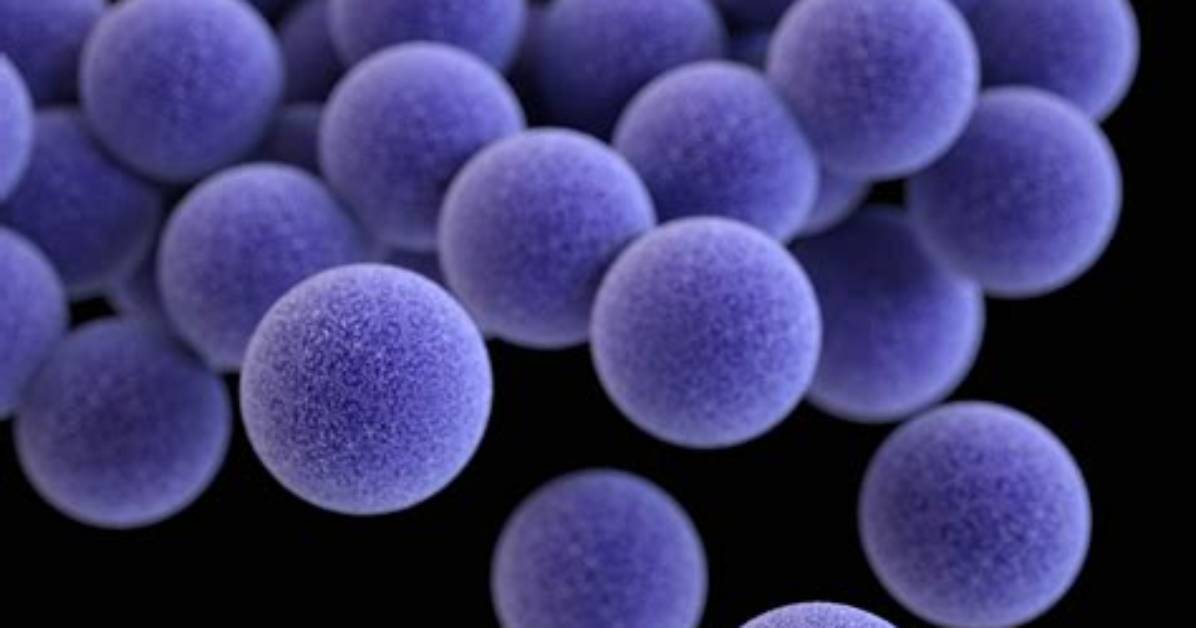 How Staphylococcus Aureus Begin?