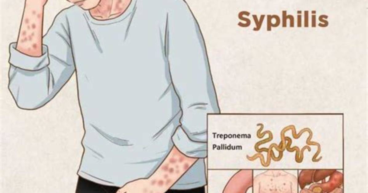 How Syphilis Is Transmitted?