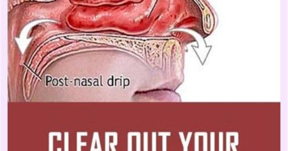 How to Clear Sinus?