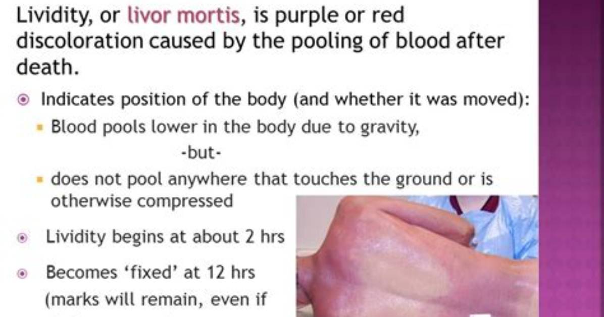 How to Determine Lividity?