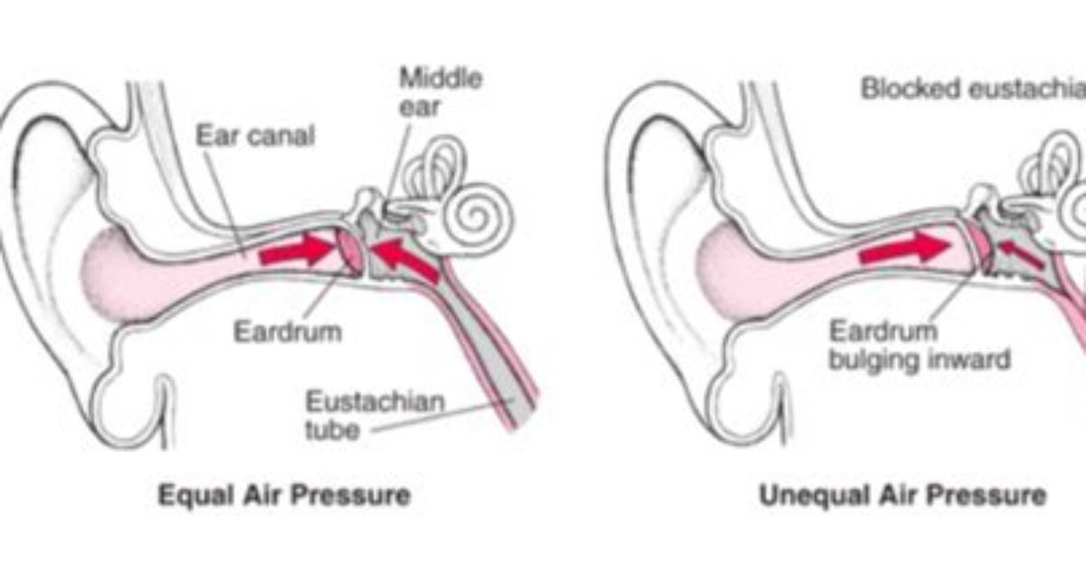 How to Equalize Ear Pressure?