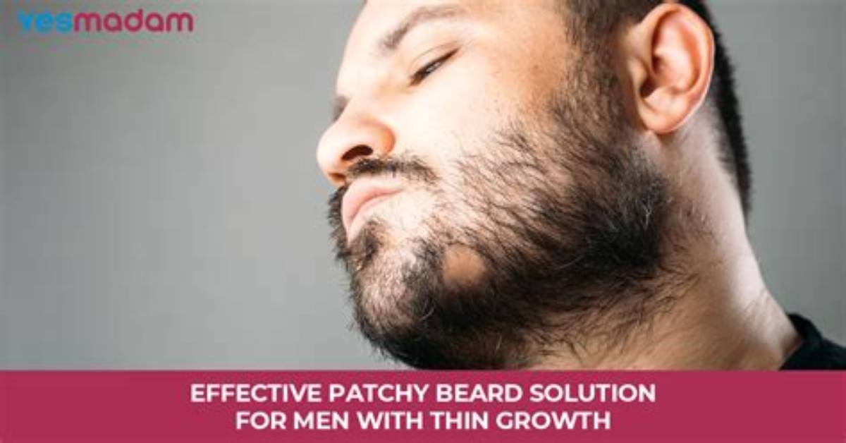 How to Fix Patchy Beard Growth?