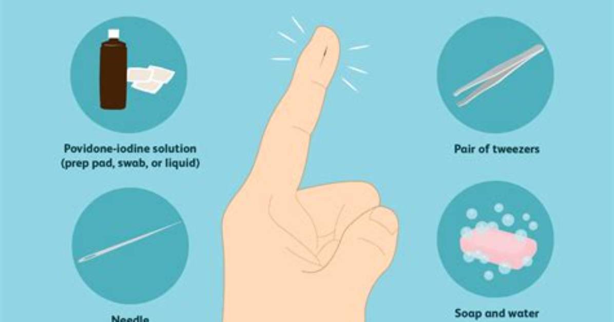 How to Get a Splinter out?