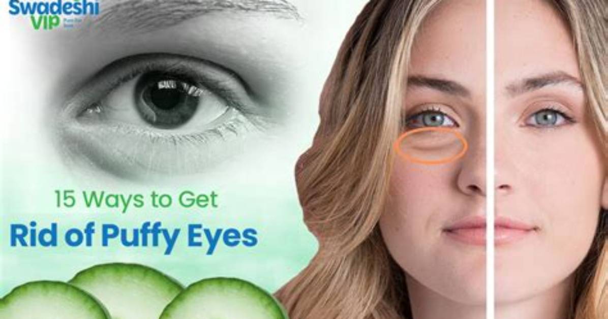 How to Get Rid of Puffy Eyes from Crying: 15 Remedies