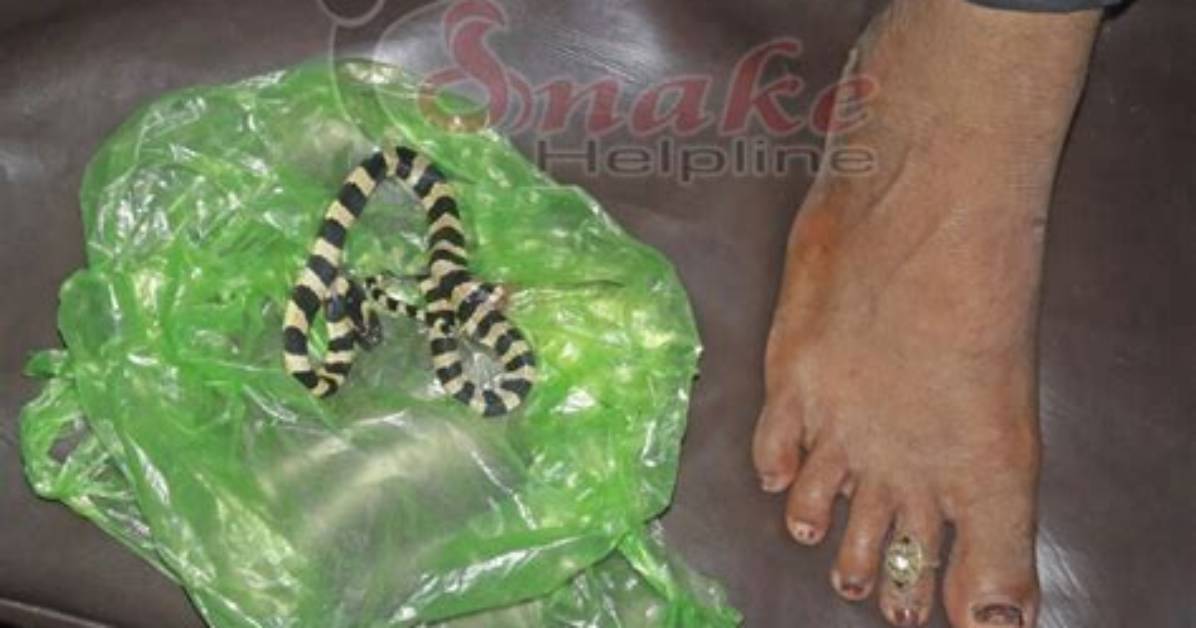 How to Identify Krait Bite?