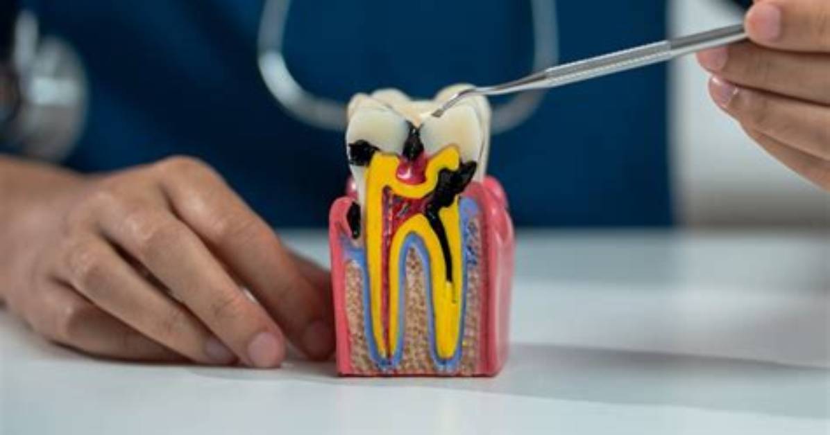 How to Keep Tooth Pulp Healthy?