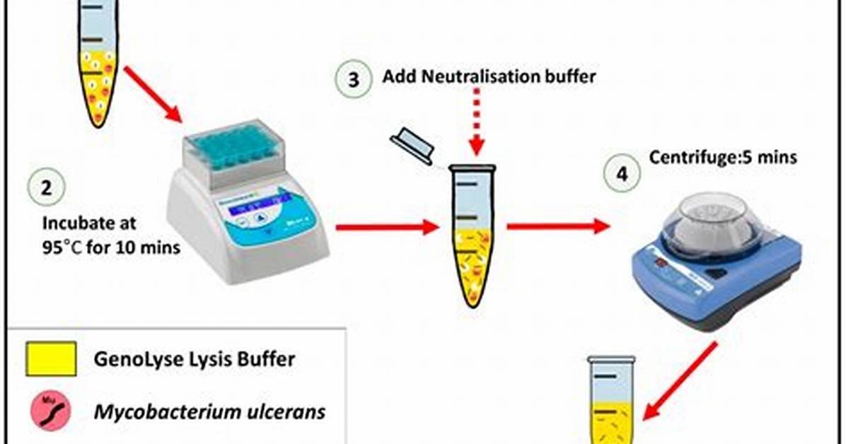How to Make Lysis Buffer?