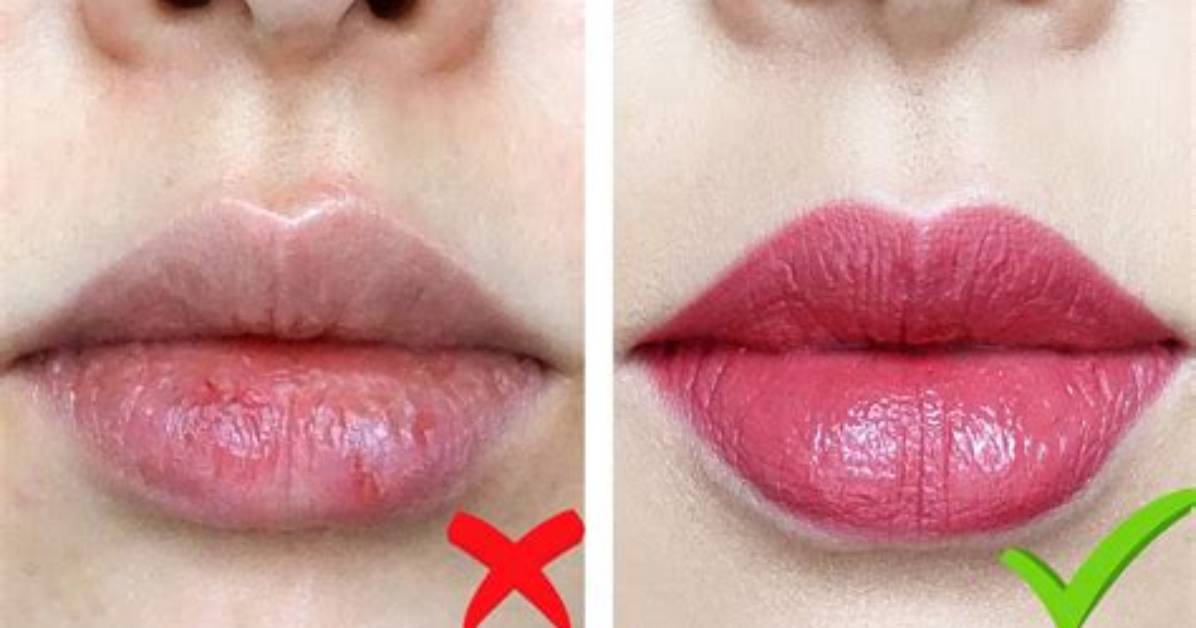 How to Make Your Lips Unchapped?
