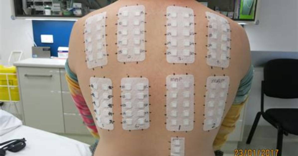 How to Patch Test?