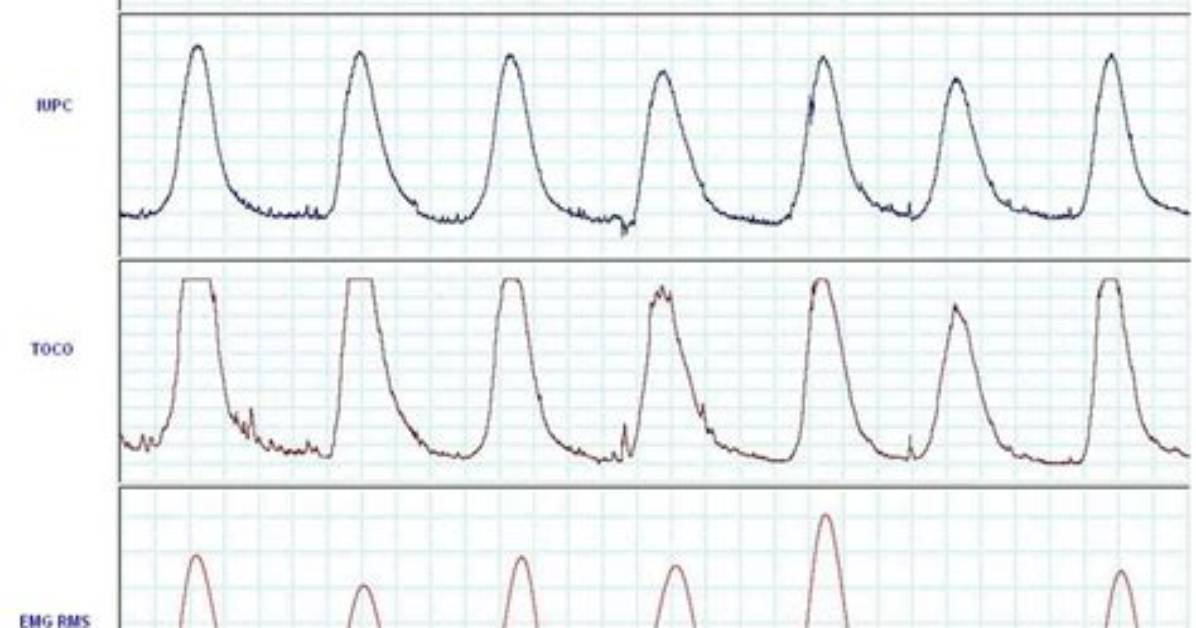 How to Read Tocometer?