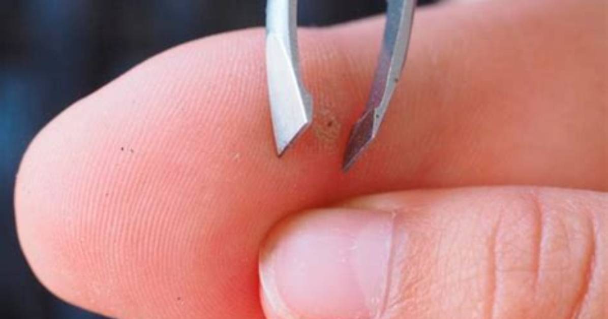 How to Remove Thorn Splinter?