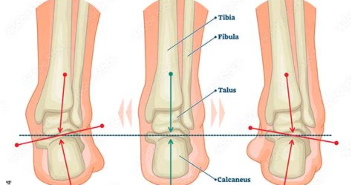 How to Stop Supination?