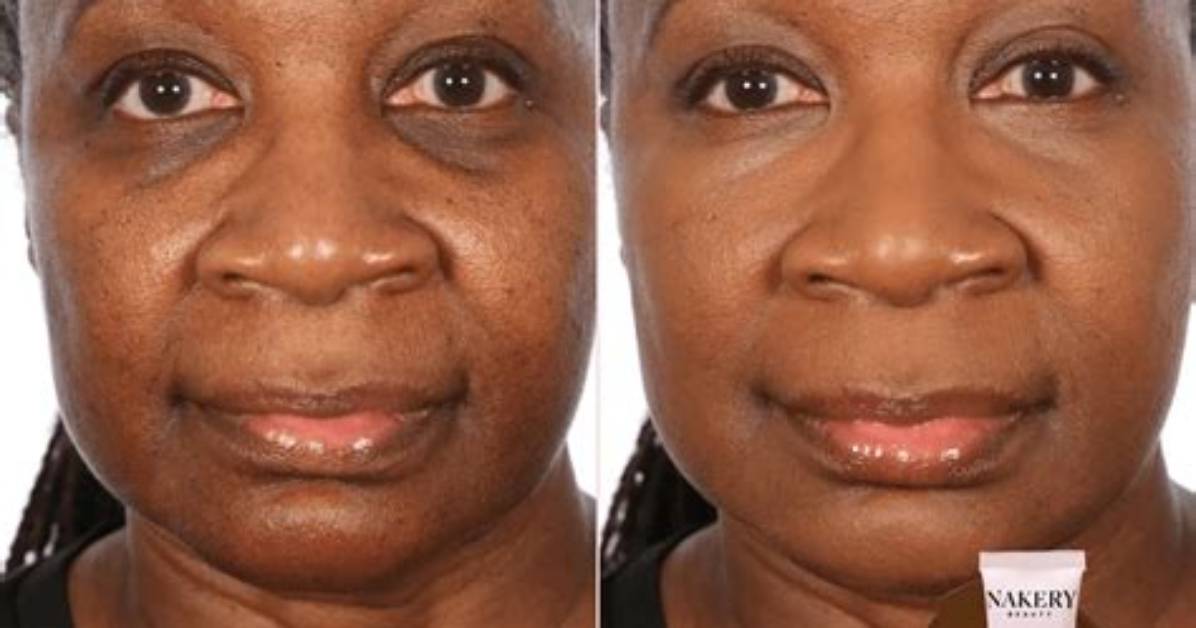 I Regularly Skip Foundation Thanks to This Retinol Treatment