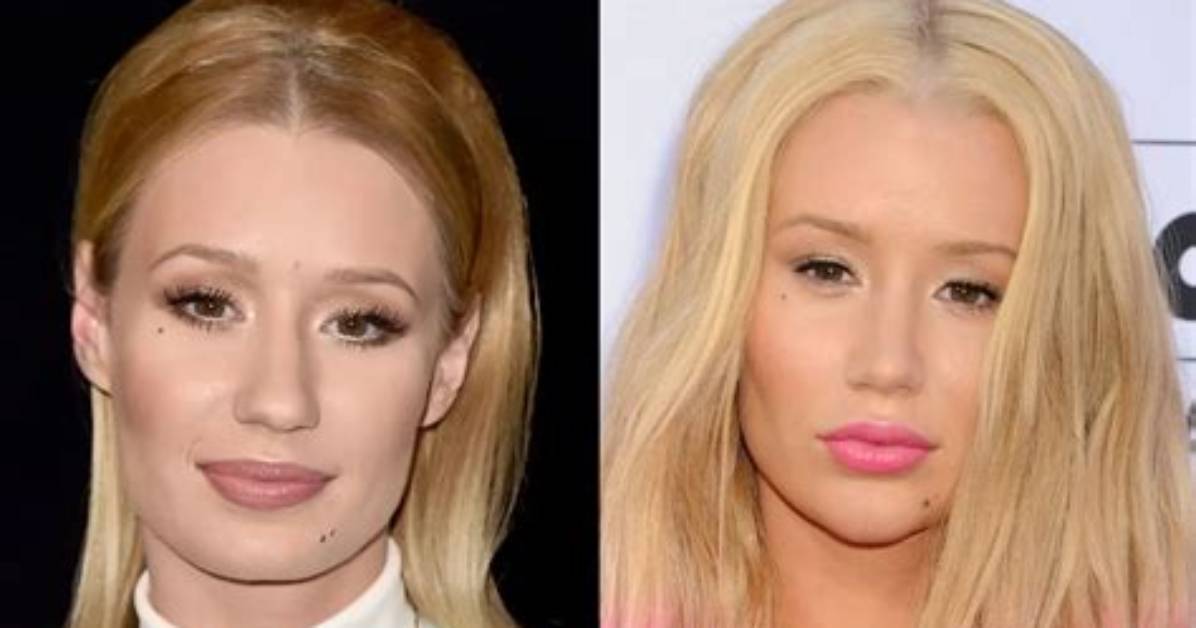Iggy Azalea Biography, Net Worth, Plastic Surgery, Age, Height, Boyfriend
