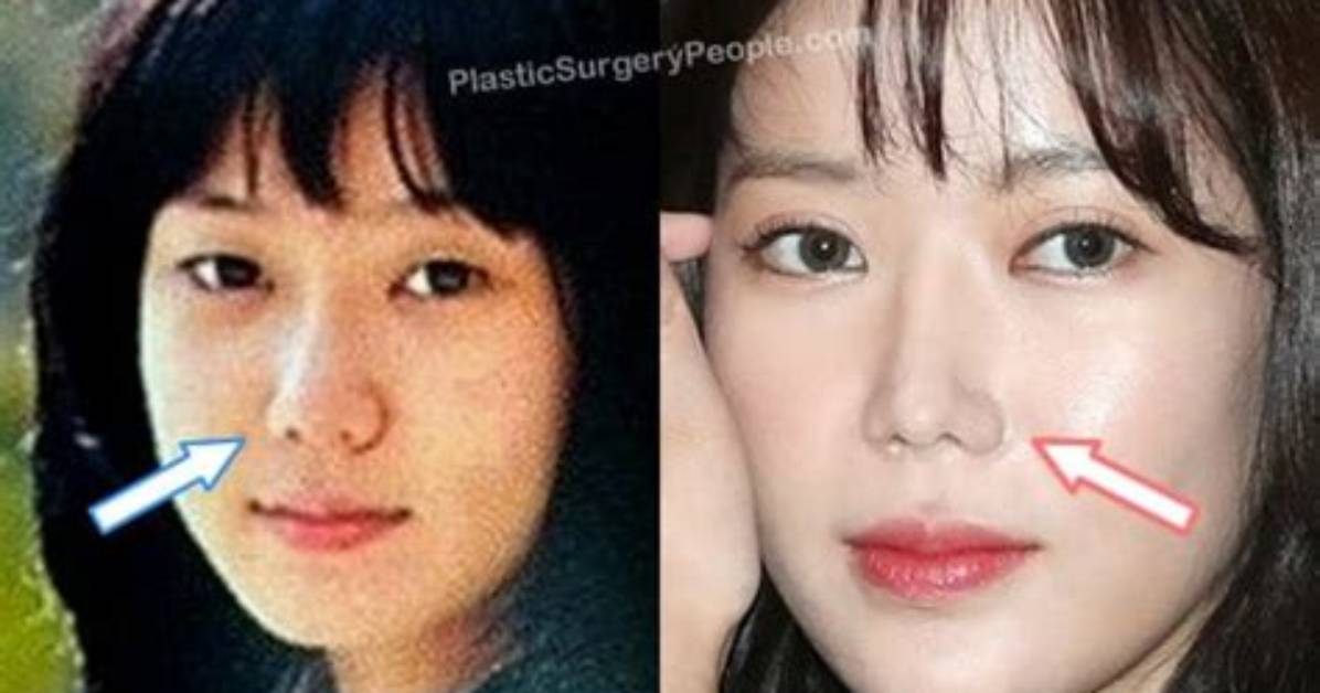 Im Soo-Hyang Plastic Surgery: Digging Deeper into the Rumors