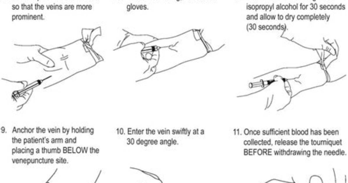 In a Venipuncture Procedure?