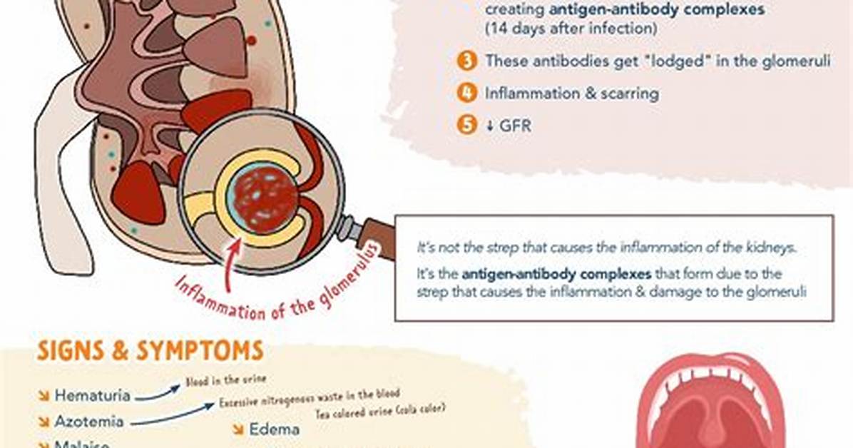 In Acute Post-Streptococcal Glomerulonephritis?