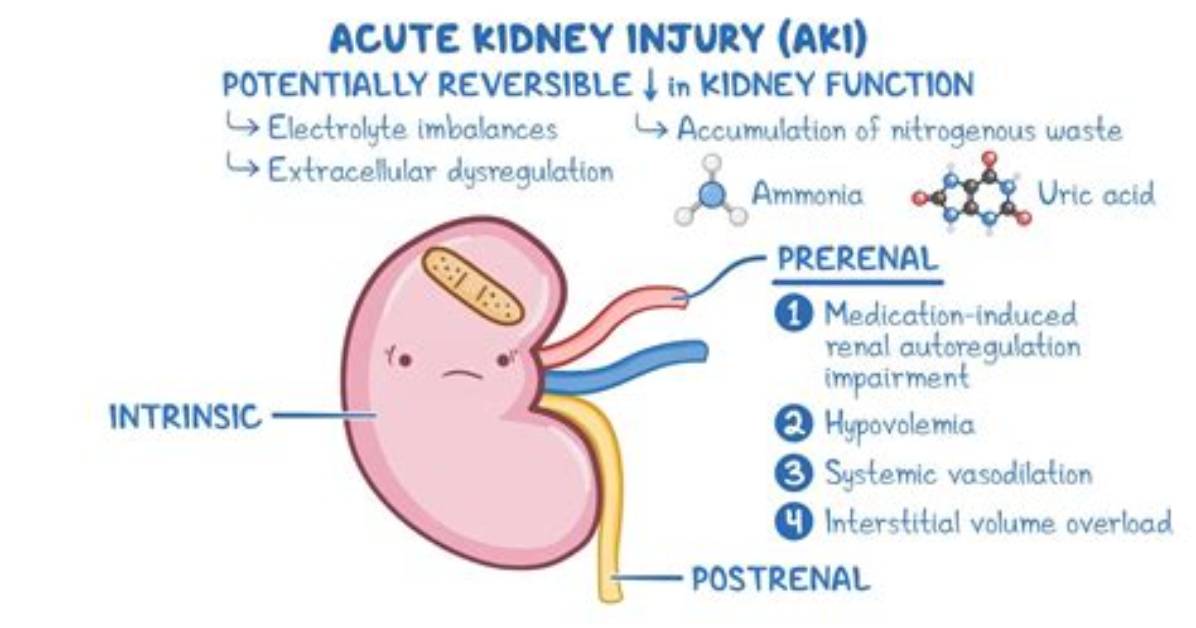 In Acute Prerenal Failure?