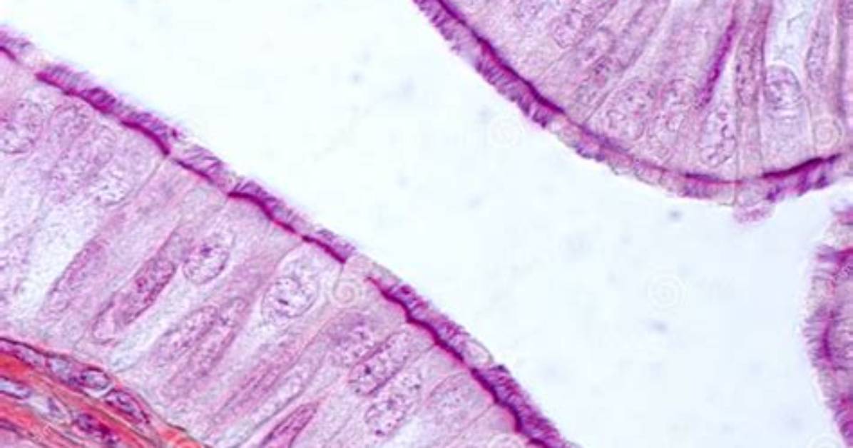 In Ciliated Simple Columnar Epithelium?