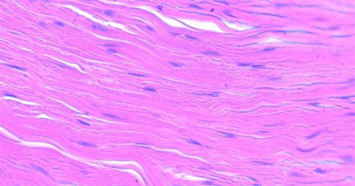 In Dense Regular Connective Tissue?