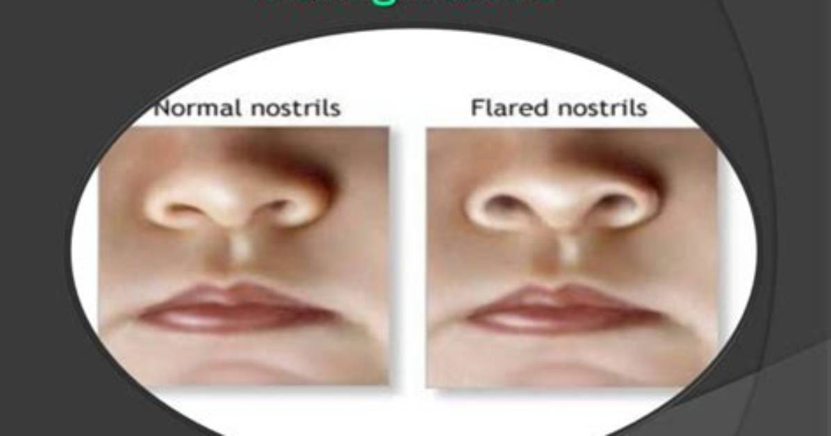 In Flared Nostrils Meaning?