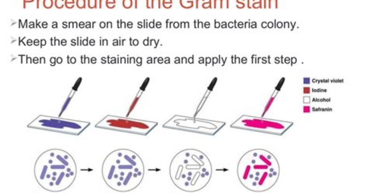 In Gram Stain Procedure?