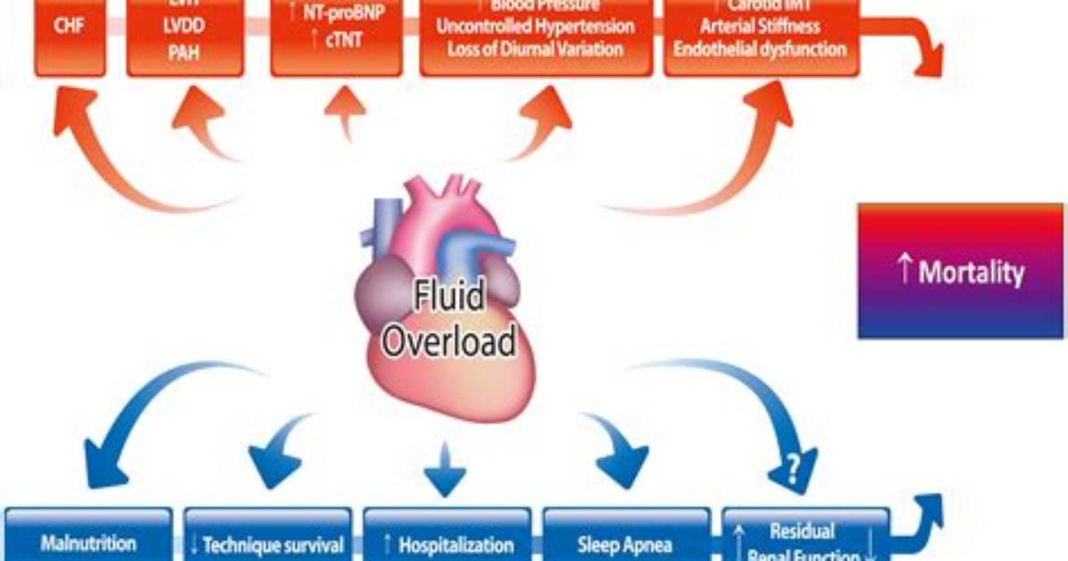 In the Fluid Overload?
