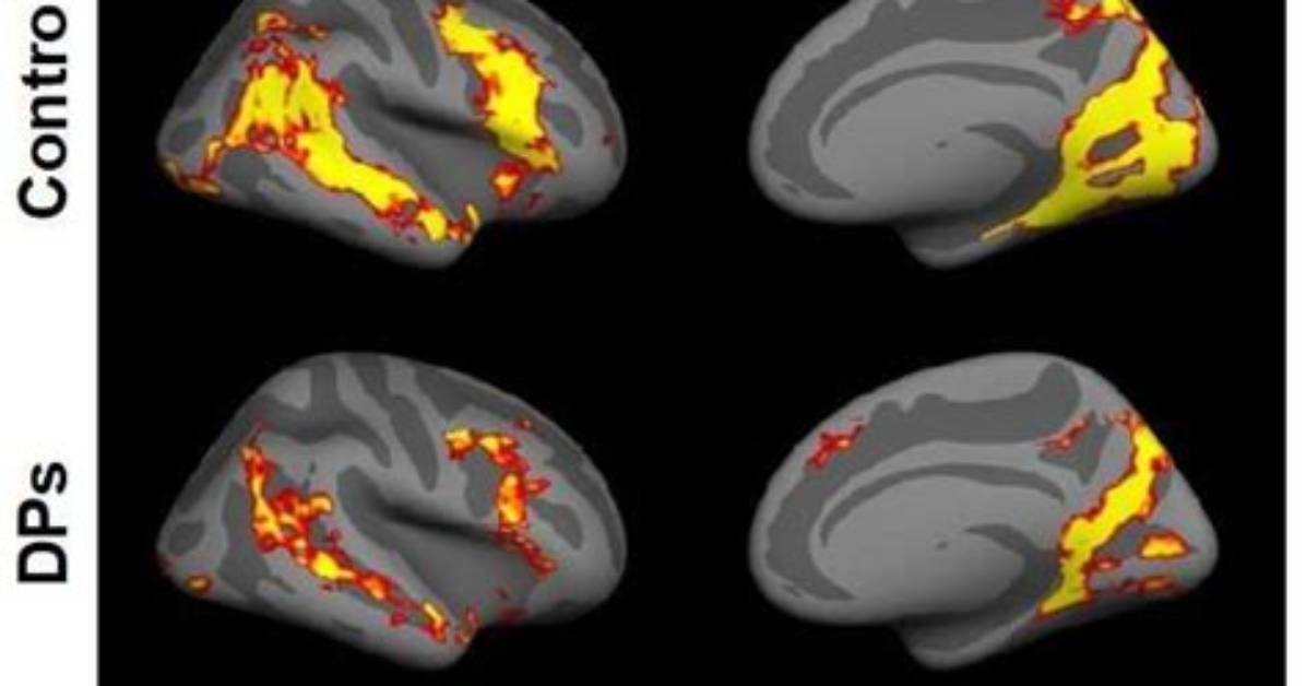 Inability to Recognize Faces Linked to Broader Visual Recognition Problems