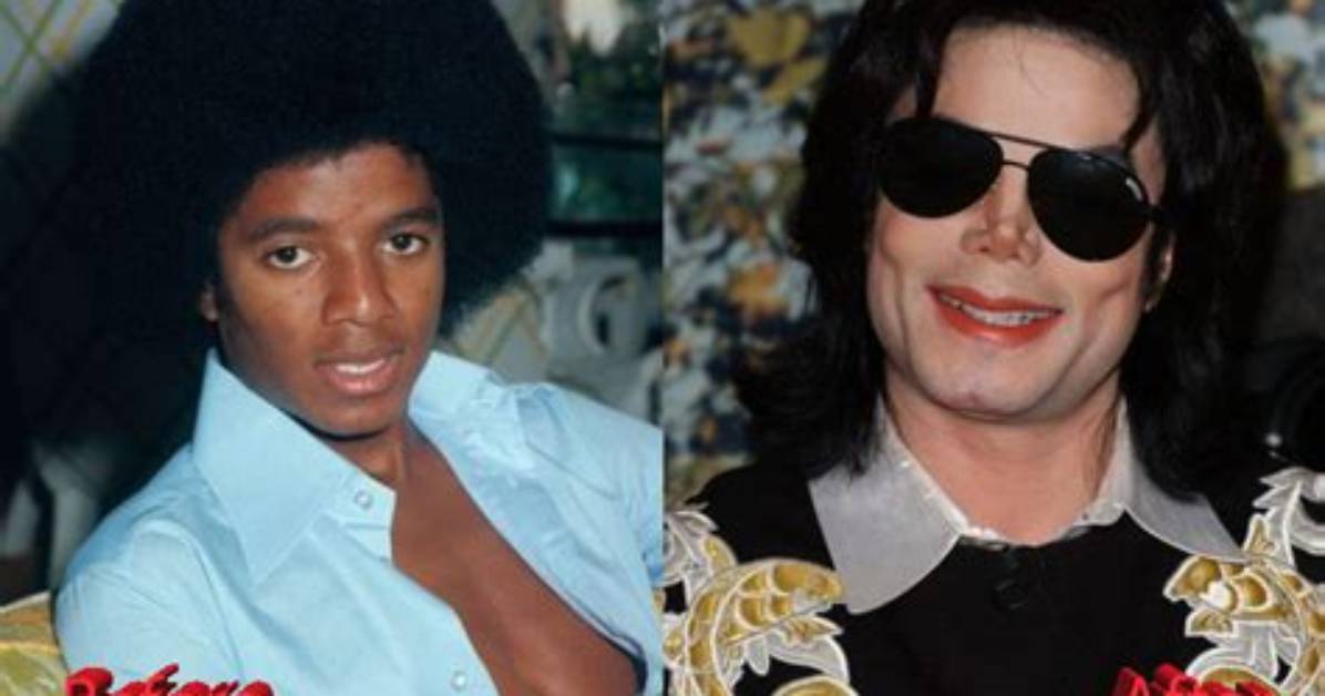 Inside Story: Michael Jackson's Plastic Surgery