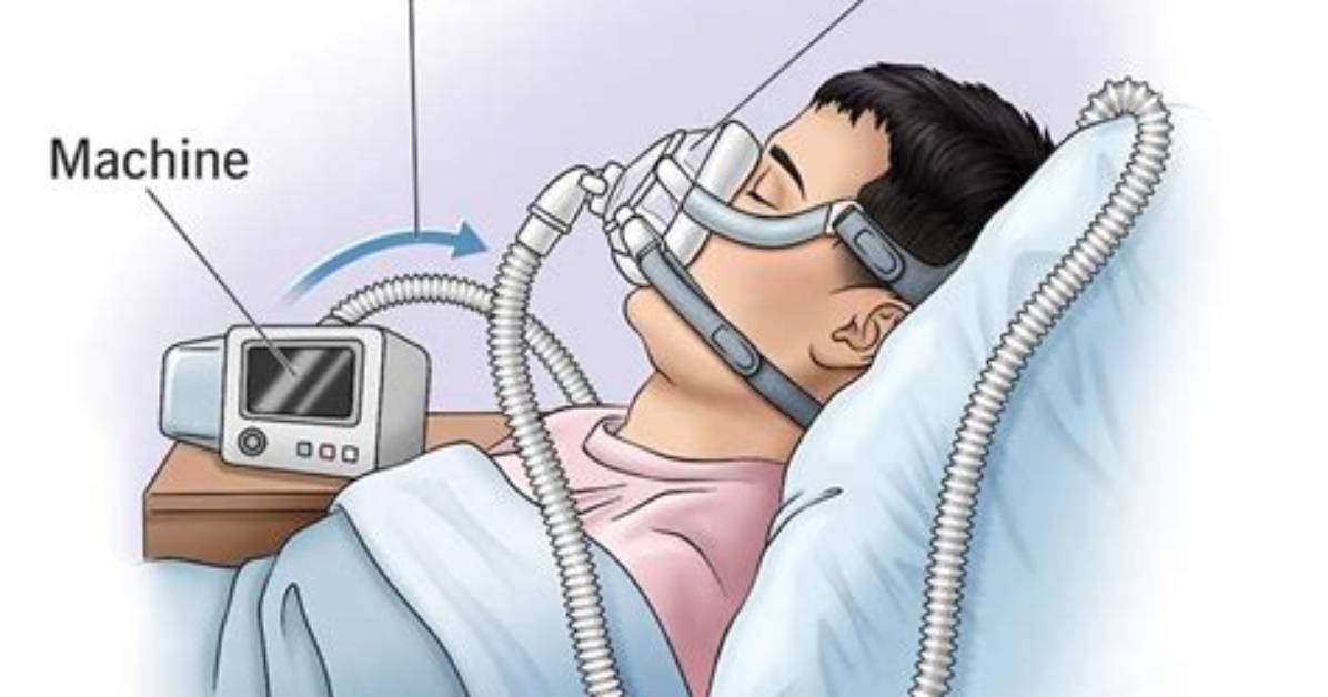 Is a Cpap an Ippb Machine