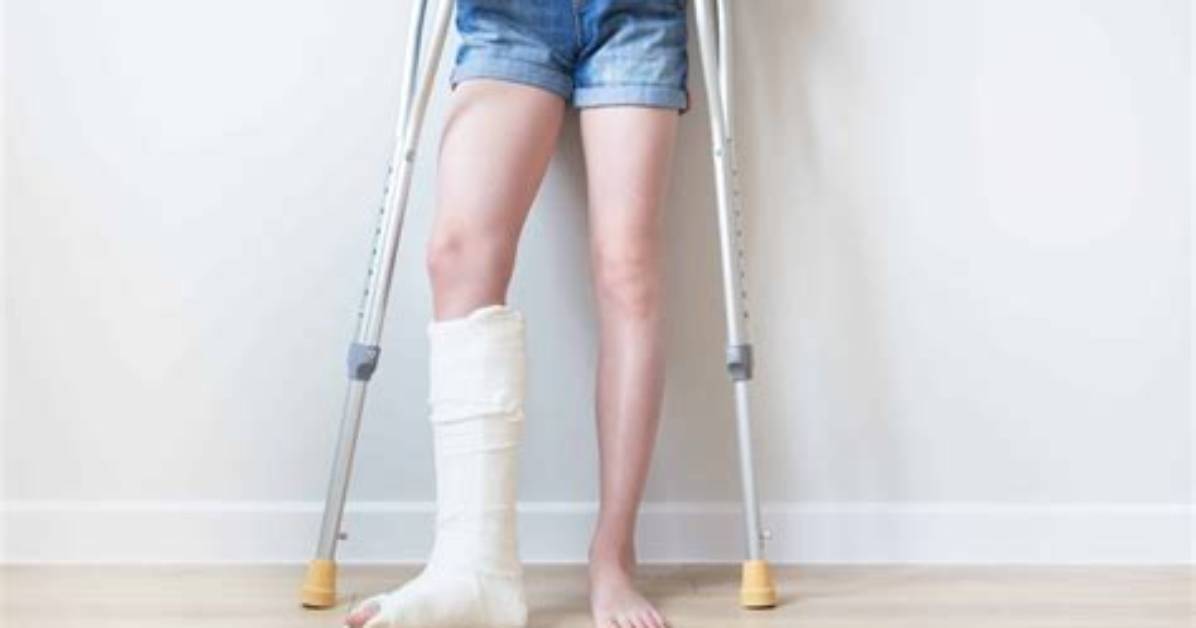 Is a Limp a Disability?