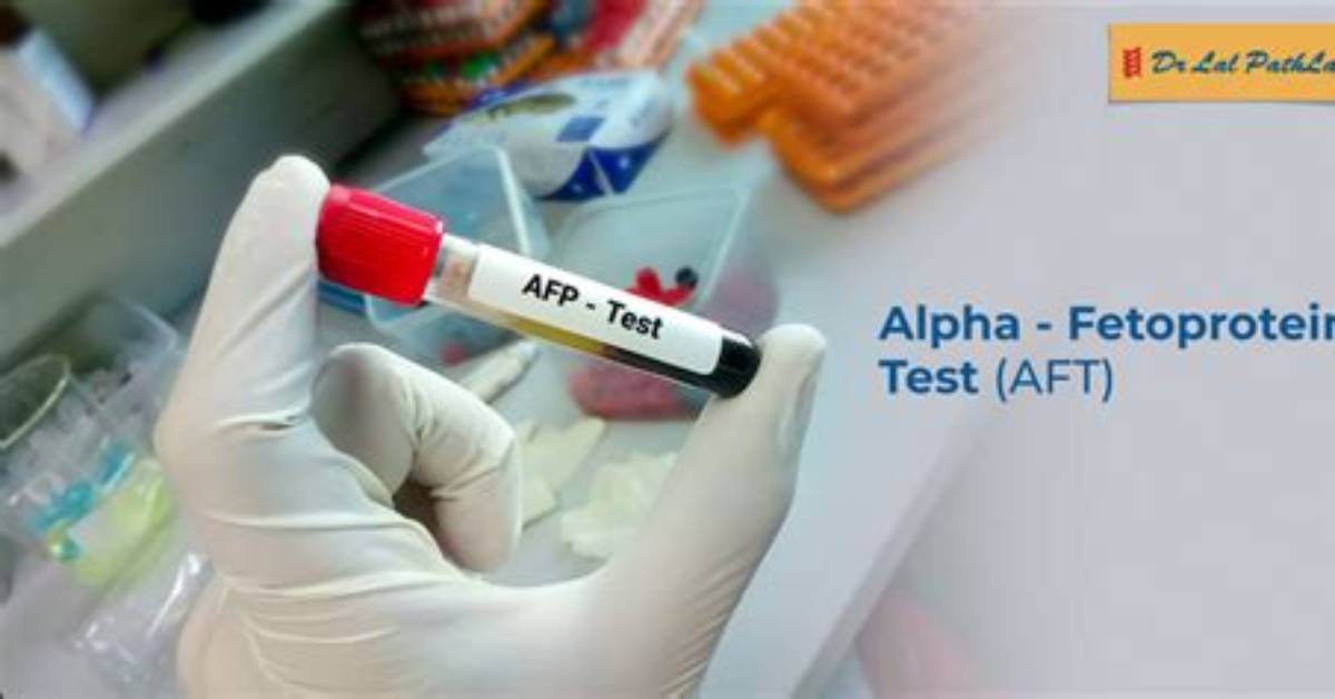 Is Afp Test Necessary?