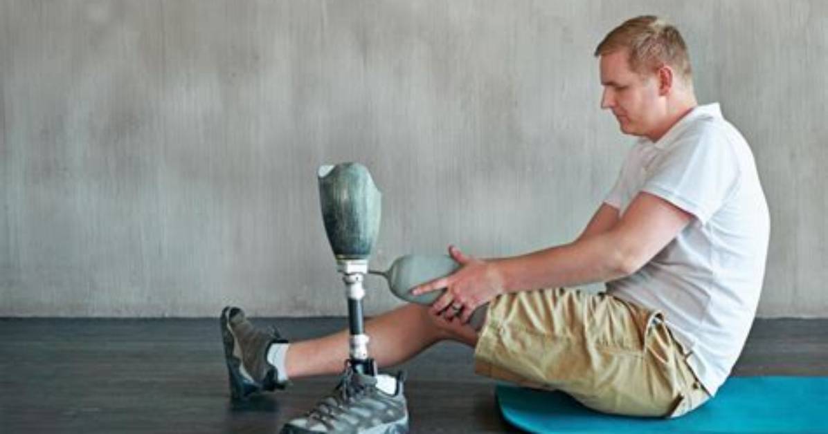 Is Amputation a Physical Disability?