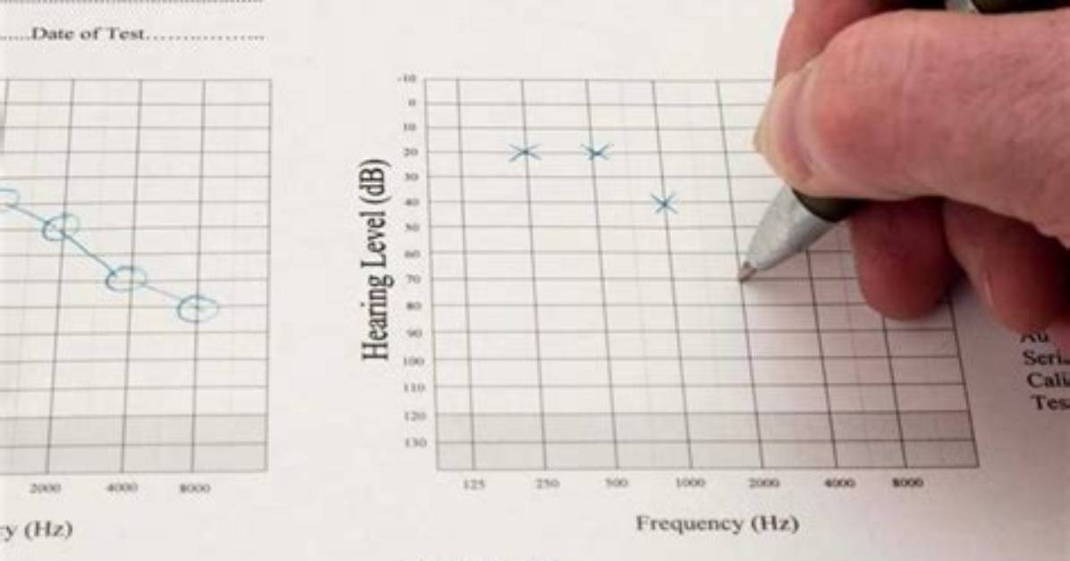 Is an Audiogram a Hearing Test?
