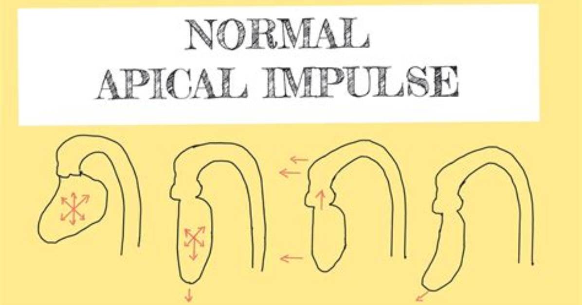 Is Apical Impulse Normal