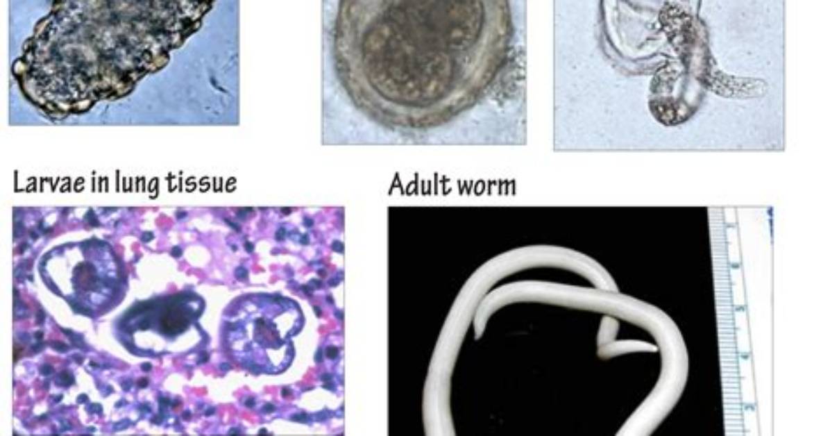 Is Ascaris a Nematode