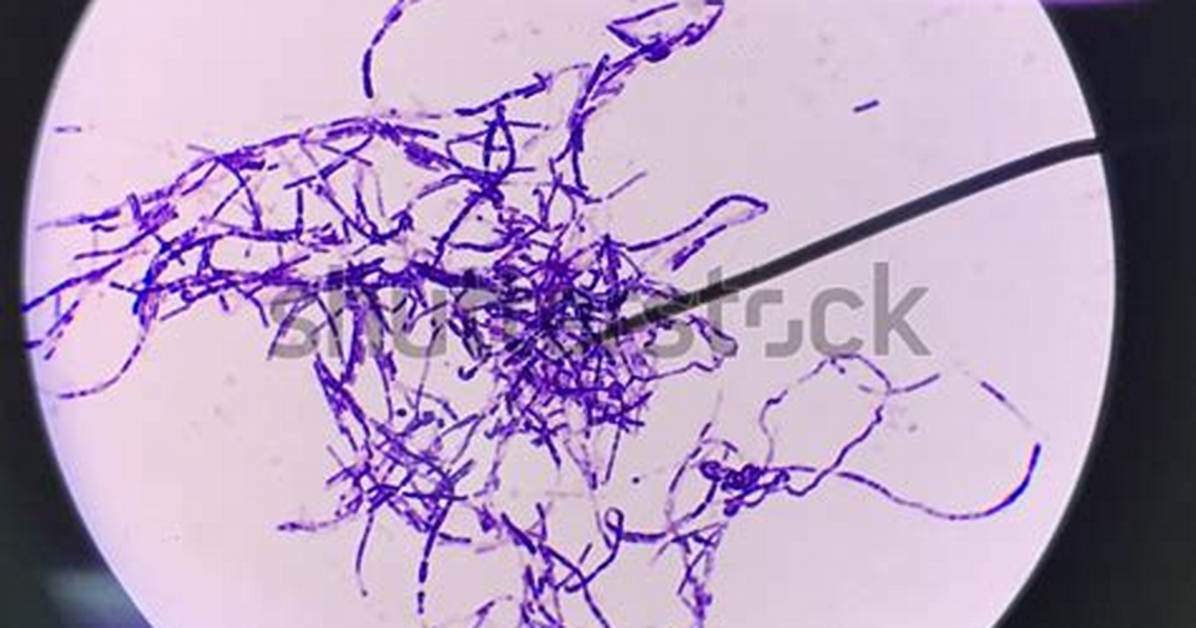 Is Bacillus Subtilis Gram Positive?