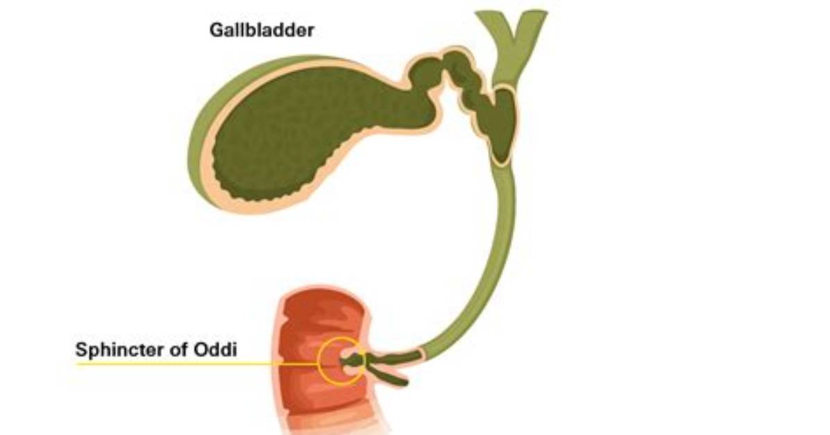 Is Biliary Dyskinesia Reversible?