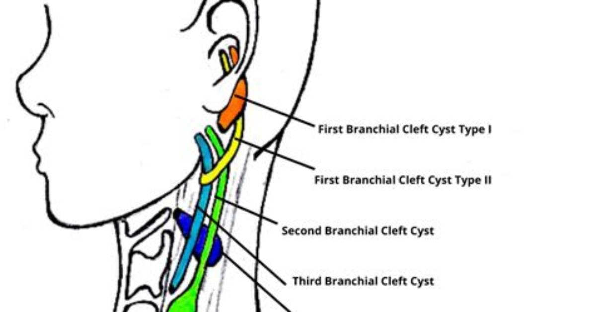 Is Branchial an Adjective?