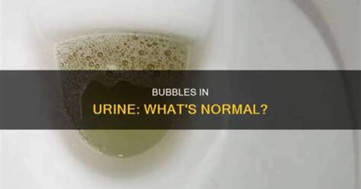 Is Bubbles in Urine Normal?
