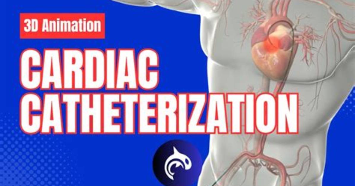 Is Catheterization Considered Surgery?
