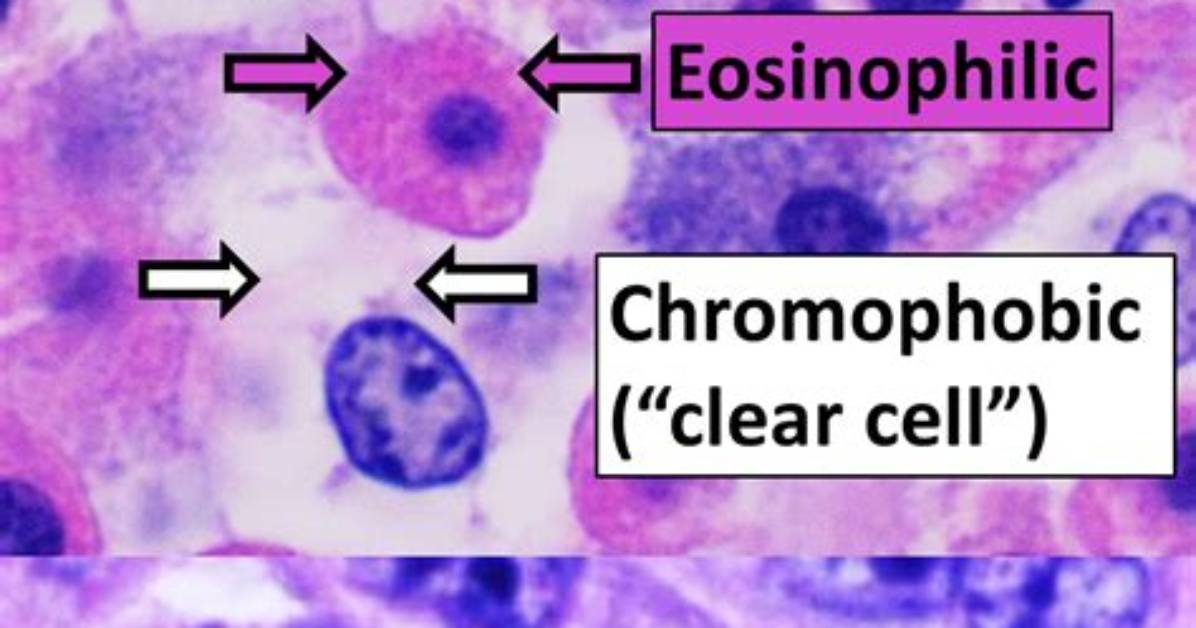 Is Chromophobe a Cell?