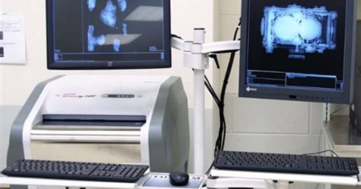 Is Computed Radiography Digital?
