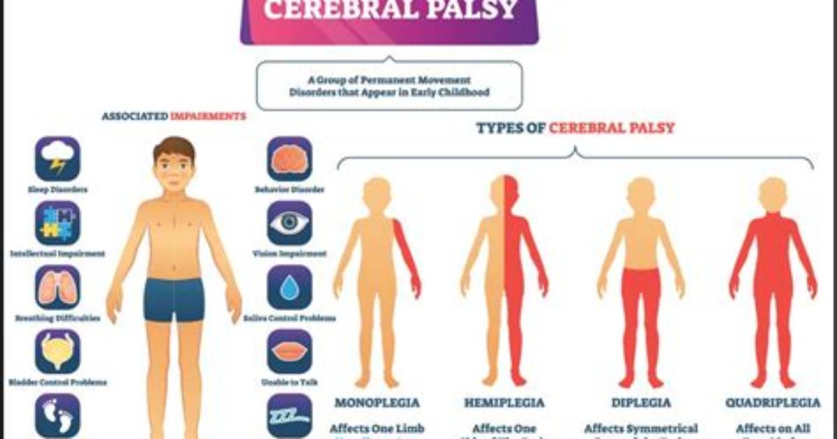 Is Cp a Disease?