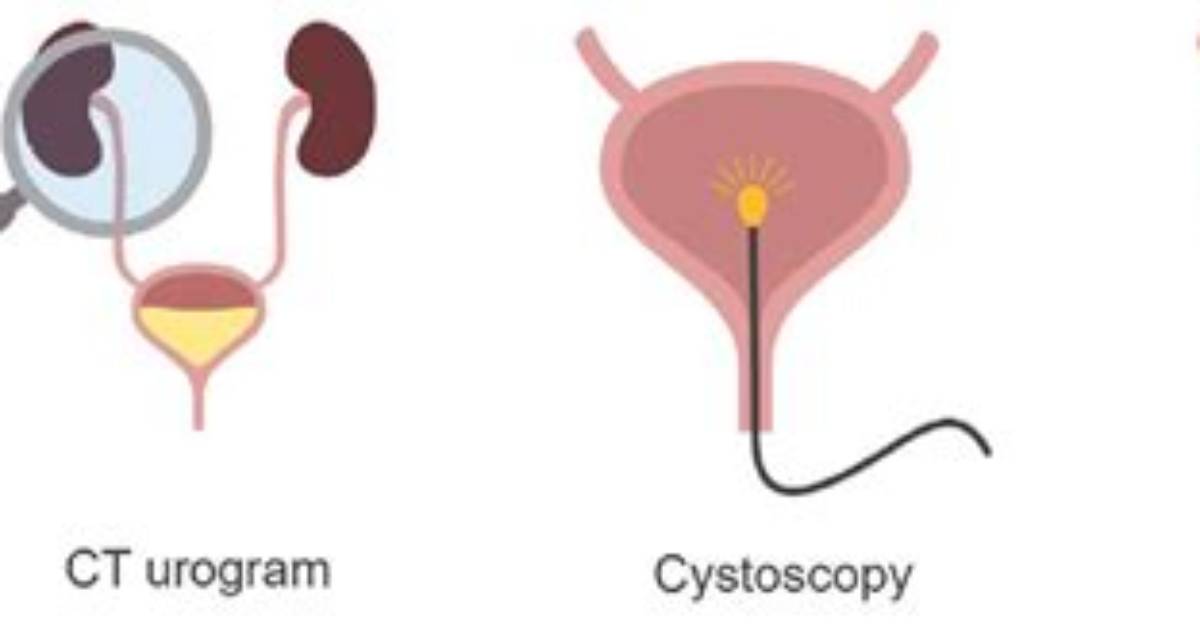 Is Cystogram and Cystography the Same Thing?