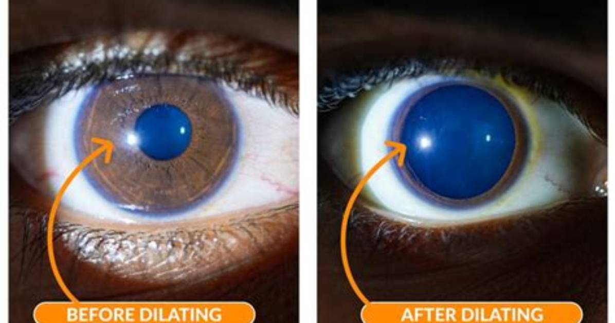 Is Dilating Eyes Safe?