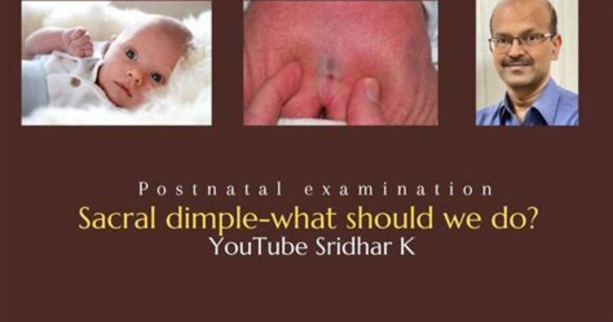 Is Dimple an Abnormality?