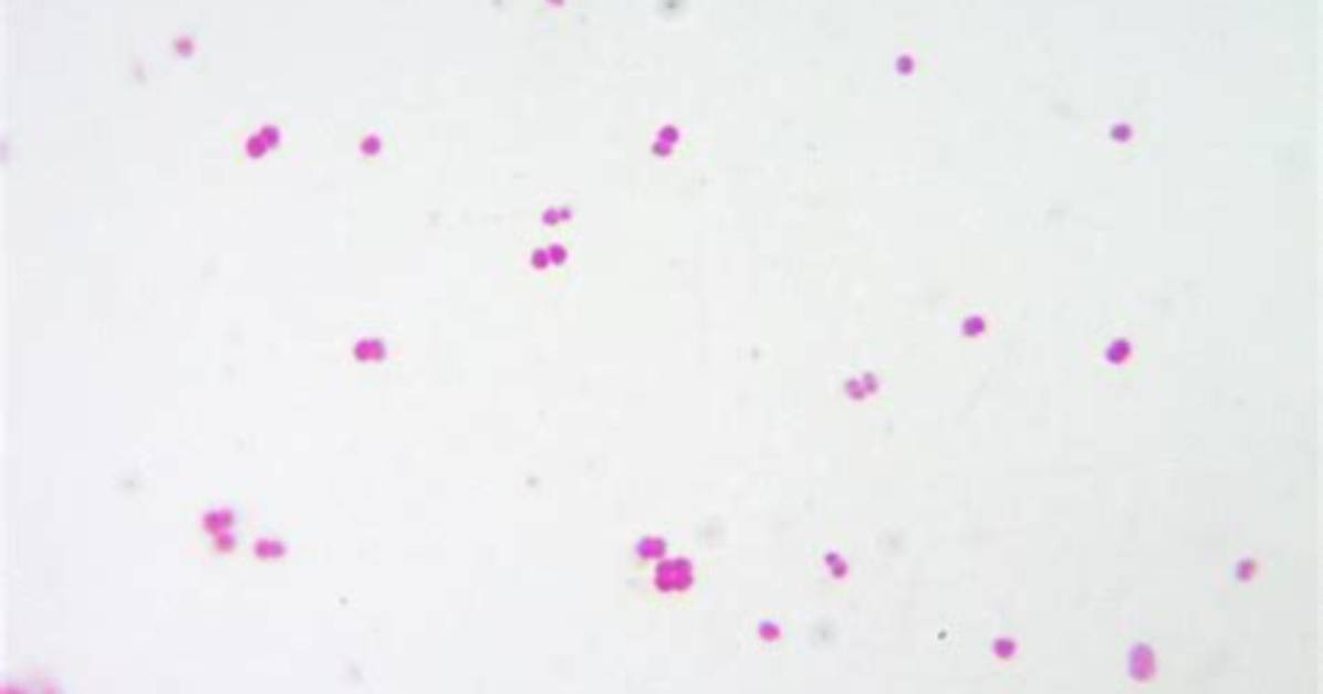 Is Diplococci Gram Negative?