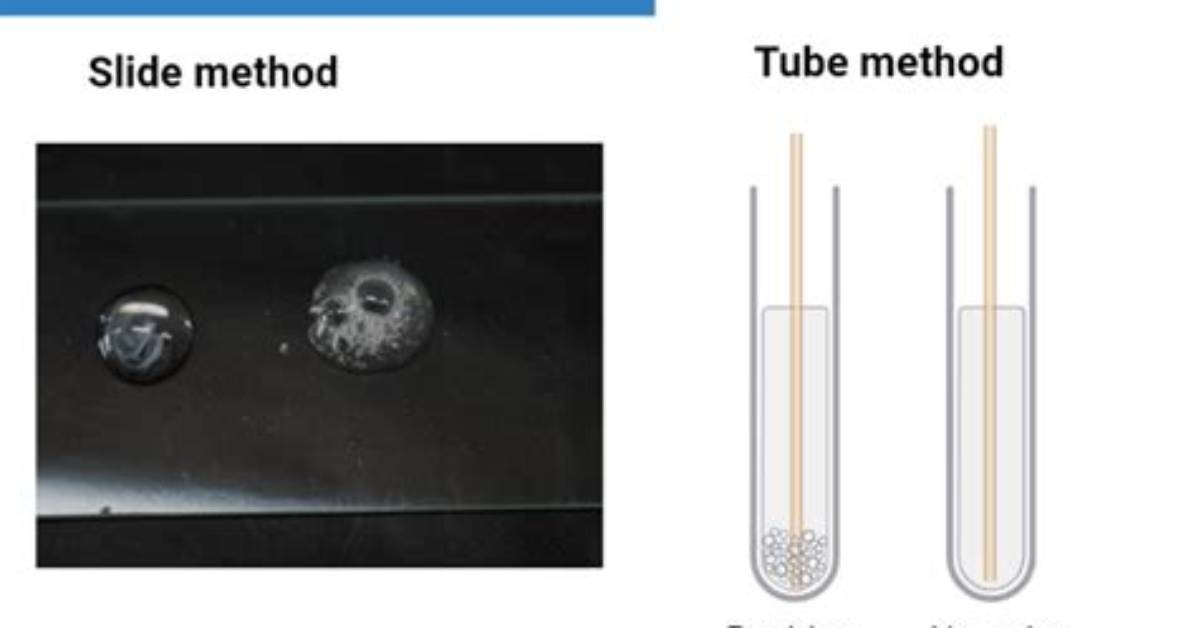 Is E Coli Catalase Positive?